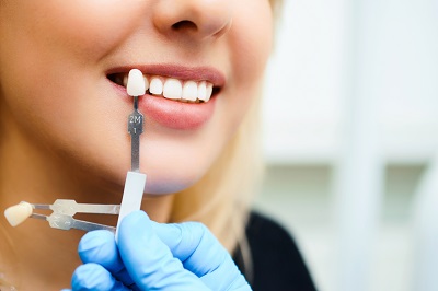 Chino Hills Dentist - Fairfield Ranch Dental - Dr. Natalie